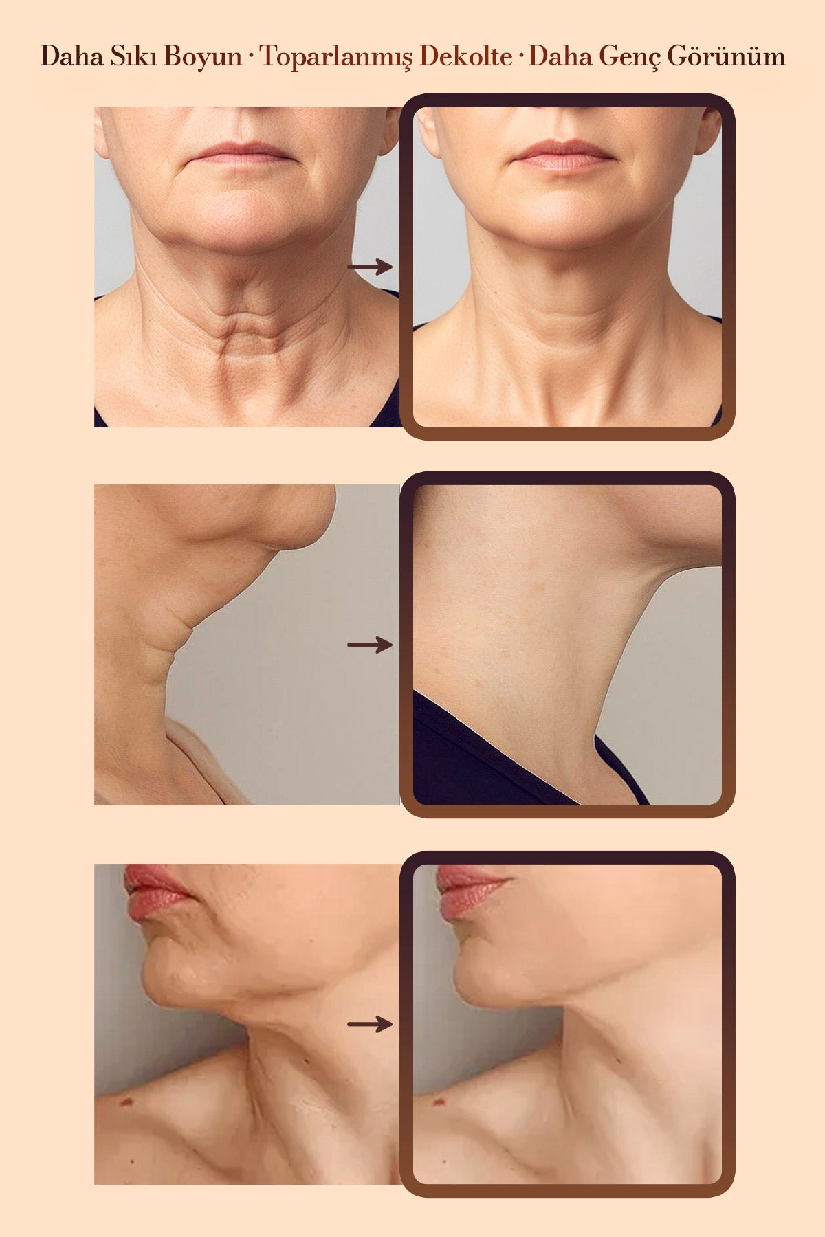 Neck Care 360 Boyun ve Dekolte Bakım Kremi 120ml